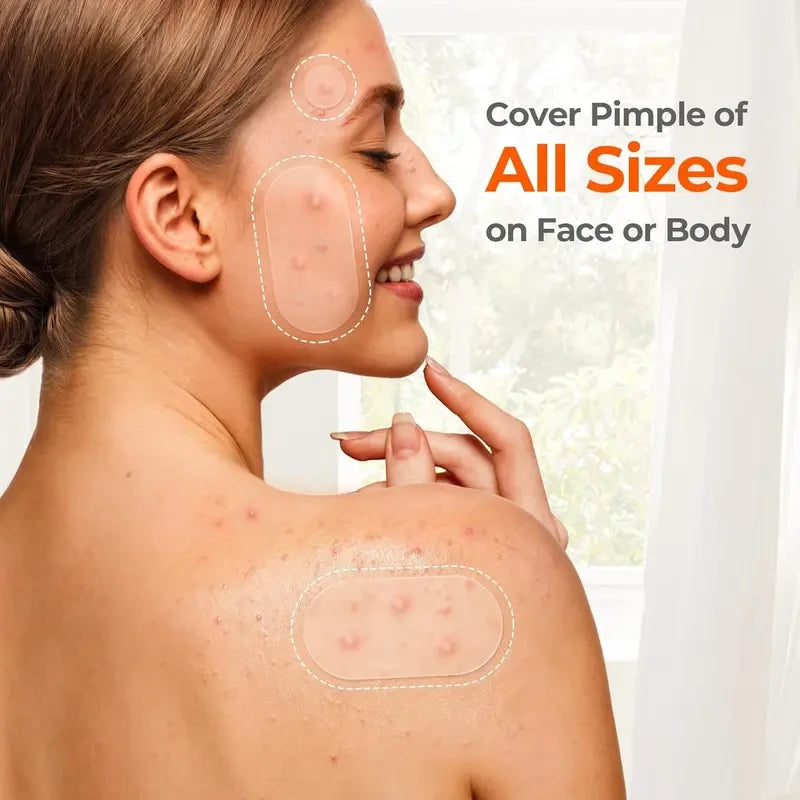 Hydrocolloid Pimple Patch Bulk Set