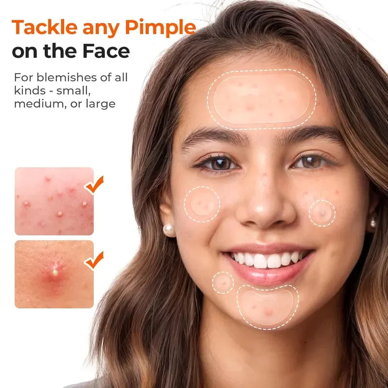 Hydrocolloid Pimple Patch Bulk Set